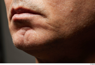 HD Face Skin Benito Romero chin face lips mouth scar…